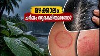മഴക്കാലത്ത് ചർമ്മവും മുടിയും സംരക്ഷിക്കണോ? ഈ ചെറിയ കാര്യങ്ങൾ ശ്രദ്ധിച്ചില്ലെങ്കിൽ പണി പാളും