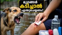 മൃഗങ്ങൾ കടിച്ചാൽ മഞ്ഞൾപ്പൊടി പുരട്ടാറുണ്ടോ? ജീവൻ രക്ഷിക്കാൻ ഈ കാര്യങ്ങൾ അറിഞ്ഞിരിക്കൂ!