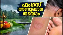 മഴക്കാലത്തെ ഫംഗസ് അണുബാധയും താരനും: ചർമ്മം സുരക്ഷിതമാക്കാൻ ഈ ലളിതമായ വഴികൾ പരീക്ഷിക്കൂ