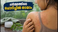 മഴക്കാലത്ത് ചർമ്മത്തിൽ ചൊറിച്ചിലും കുരുക്കളും? അണുബാധ തടയാൻ ഈ കാര്യങ്ങൾ ശ്രദ്ധിക്കൂ