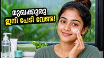 മഴക്കാലത്ത് മുഖക്കുരു കൊണ്ട് ബുദ്ധിമുട്ടുകയാണോ? കൗമാരക്കാർക്കായി ഇതാ തിളങ്ങുന്ന ചർമ്മം നേടാൻ ലളിതമായ വഴികൾ