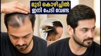 മുടി കൊഴിച്ചിൽ ഇനി പേടി വേണ്ട; പിആർപി ചികിത്സയിലൂടെ തിരികെ നേടാം കരുത്തുറ്റ മുടി