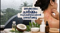 Kerala Rain Alert 2026 Tips To Protect Skin And Scalp From Humidity 011