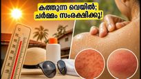 കത്തുന്ന വെയിലിലും ഈർപ്പത്തിലും ചർമ്മം തളരുന്നുണ്ടോ? തിളക്കം നിലനിർത്താൻ ഈ ലളിതമായ വഴികൾ പരീക്ഷിക്കൂ