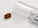 Natural Ways Dissolve Kidney Stones