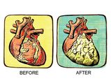 Heart Problems Arises Due These Habits.html
