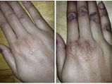 Excellent Home Remedies For Dark Finger Joints And Fingers