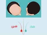 இரண்டே மாதங்களில் முடியின் அடர்த்தியை அதிகரிக்கும் ஓர் அற்புத ஹேர் மாஸ்க்!