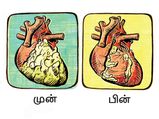 Six Ayurveda Remedies Healthy Heart