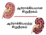 நச்சுக்களை முற்றிலுமாக போக்கி, சிறுநீரக கற்களை கரைக்க இந்த ஜூஸ் குடிங்க!