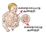 சுன்னத் செய்வதன் கட்டாயம் மற்றும் அதனால் ஏற்படும் நன்மைகள் என்ன?