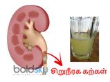 சிறுநீரக கற்களை கரைக்க இந்த ஜூஸை தினமும் அரை டம்ளர் குடித்தால் போதும்!