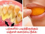 பற்களில் படிந்திருக்கும் மஞ்சள் கரையை போக்கும் எளிய வீட்டுமுறை!