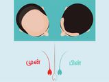 10 நாட்களில் தலையில் இருந்து கொட்டிய முடியை மீண்டும் வளரச் செய்யும் சில வழிகள்!