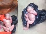 Abandoned Newborn With Umbilical Cord Found A Discarded Plastic Bag