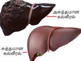 72 மணிநேரத்தில் கல்லீரலை சுத்தம் செய்து உடல் எடையைக் குறைக்க இத ஒரு டம்ளர் குடிங்க...