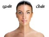 முகத்தில் அசிங்கமாக இருக்கும் கருமைப் புள்ளிகளை மறைக்க உதவும் சில வழிகள்!