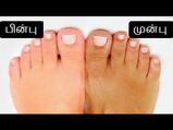 கருமையாக இருக்கும் கால்களை வெள்ளையாக்கும் ஓர் எளிய முறை!