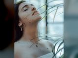 A Girl With Numerous Birthmarks Who Became Model