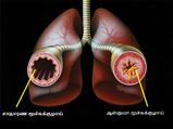 இந்த ஒரு பொருள் ஆஸ்துமா பிரச்சனைக்கு குட்-பை சொல்ல வைக்கும்...!