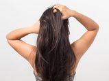 Treating Oily Scalp With Home Remedies