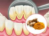 Does Turmeric Help In Teeth Whitening