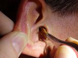A Man Gave His Ear For Live Cockroaches