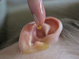 Home Remedies To Remove Ear Wax