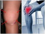 This Drink May Help You To Eliminate Knee And Joint Pain In Just 5 Days