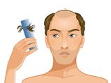 Hair Loss Causes Symptoms Treatment And Prevention