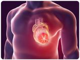 Everything You Need To Know About Heart Tumors