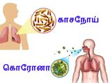 காசநோய் மற்றும் கொரோனா - இரண்டிற்கும் உள்ள ஒற்றுமை என்னென்ன தெரியுமா?