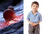 All About Rhabdomyosarcoma Cancer In Children