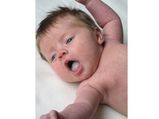 Home Remedies For Oral Thrush In Babies