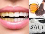Here S How Mustard Oil And Salt Help Keep Your Teeth Clean