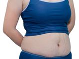 6 Easy Steps To Lose Belly Fat After Delivering A Baby