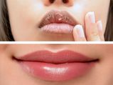 தேனை உங்க உதடுகளில் இப்படி பயன்படுத்தினால் உங்க உதடு அழகா கவர்ச்சியா மாறுமாம்...ட்ரை பண்ணி பாருங்க!