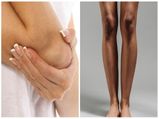 Homemade Remedies For Dark Elbows Knees In Tamil