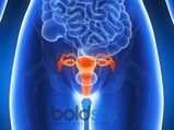 Fibroids A Serious Cause That Can Affect Women S Fertility In Tamil