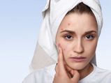 Easy Tips To Reduce Teenage Acne In Tamil