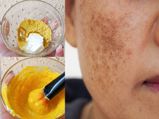 How To Remove Black Spots From Face In Tamil