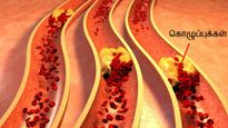 Foods That Cleanse Blood Vessels In Tamil