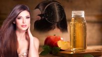 How To Use Apple Cider Vinegar For Dandruff In Tamil