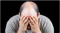 Ayurvedic Ways To Get Rid Of Male Baldness In Tamil