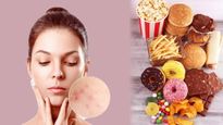 These Foods Away To Keep Acne At Bay Before Your Big Day In Tamil