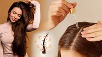 Reasons Why You Need A Scalp Serum In Your Hair Care Routine In Tamil