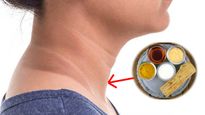 Easy Remedies To Remove Dark Patches On Neck In Tamil