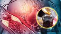 Homemade Syrup To Cure Heart Blockage In Tamil