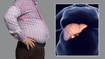 How To Identify Fatty Liver Disease In Tamil