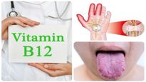 வைட்டமின் பி12 குறைபாடு உங்களுக்கு ஏற்படாமல் இருக்க...இந்த சைவ உணவுகள நீங்க சாப்பிட்டா போதுமாம்!